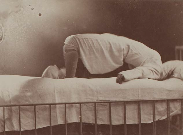Hysteria : Les planches du docteur Charcot à la Salpêtrière