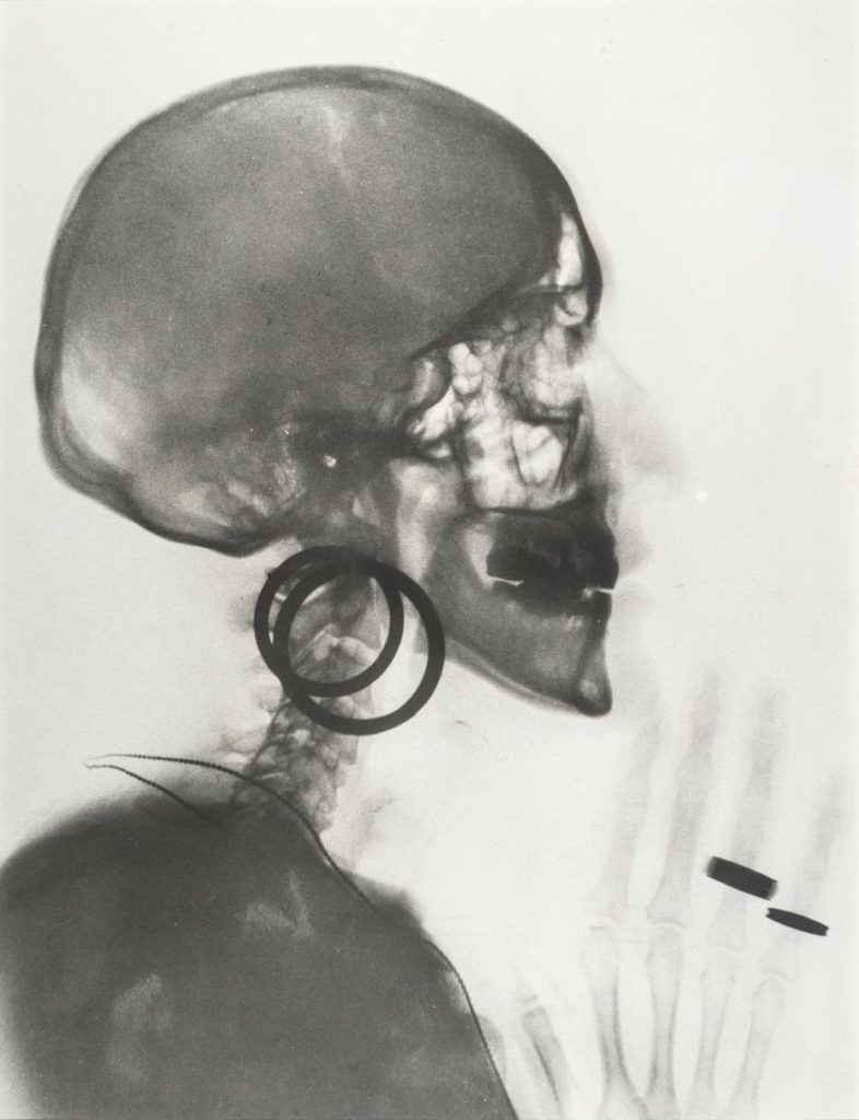 Meret Oppenheim (1913-1985), Radiographie du crâne de M. O., 1964 (Röntgenaufnahme des Schädels M. O.) Crédit photo : Peter Freeman, Inc. © ADAGP, Paris 2016